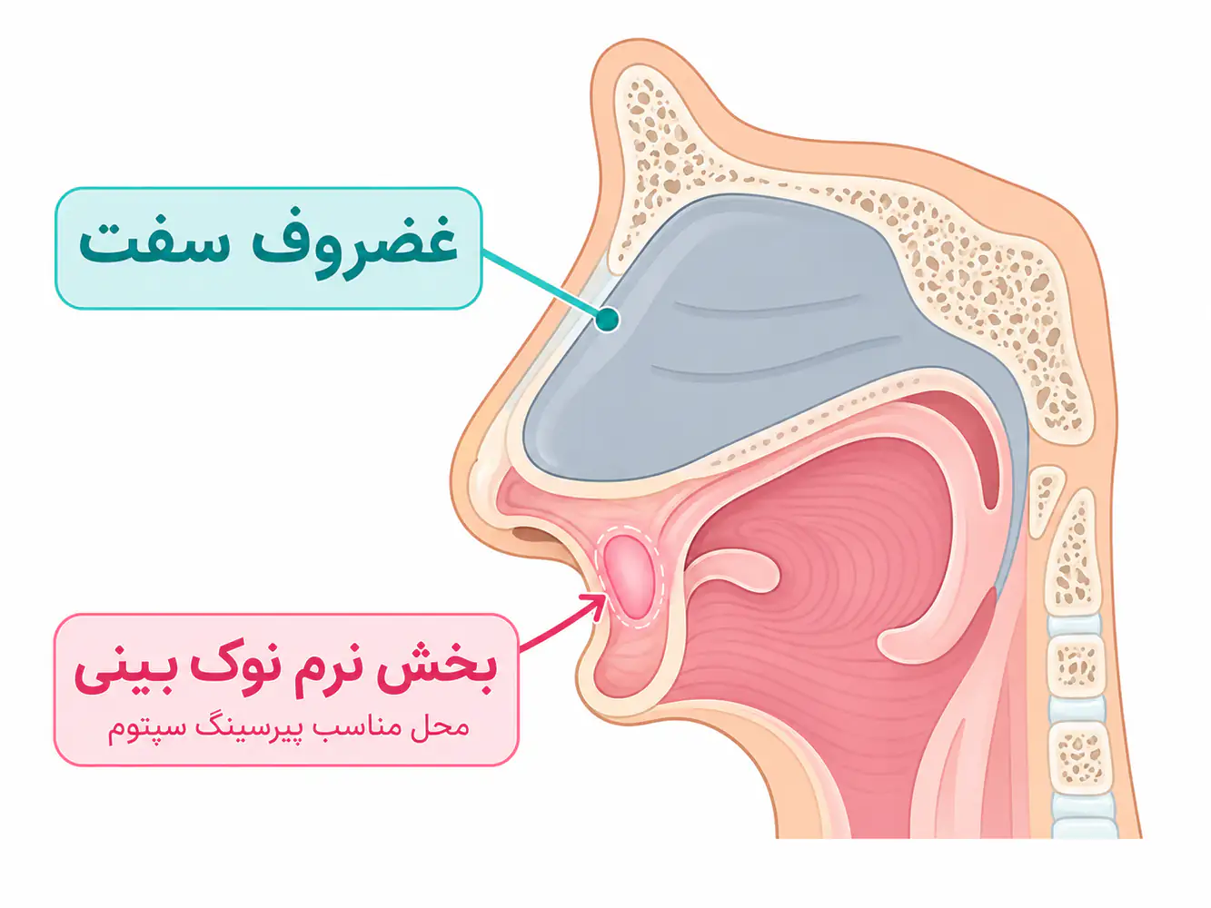 تصویر انیمیشنی از داخل بینی و محل دقیق sweet spot برای پیرسینگ سپتوم