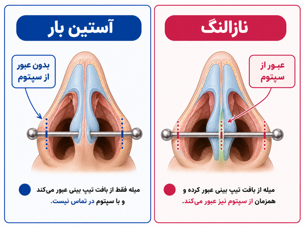 انیمیشن مقایسهای آستینبار و ناسالانگ با یه برش از پایین بینی که مسیر هر کدام رو نشون میده
