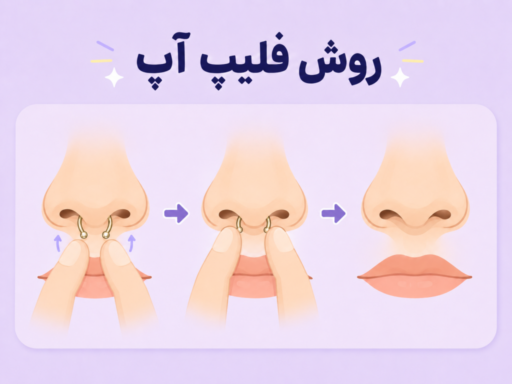 مراحل فلیپ آپ کردن سپتوم