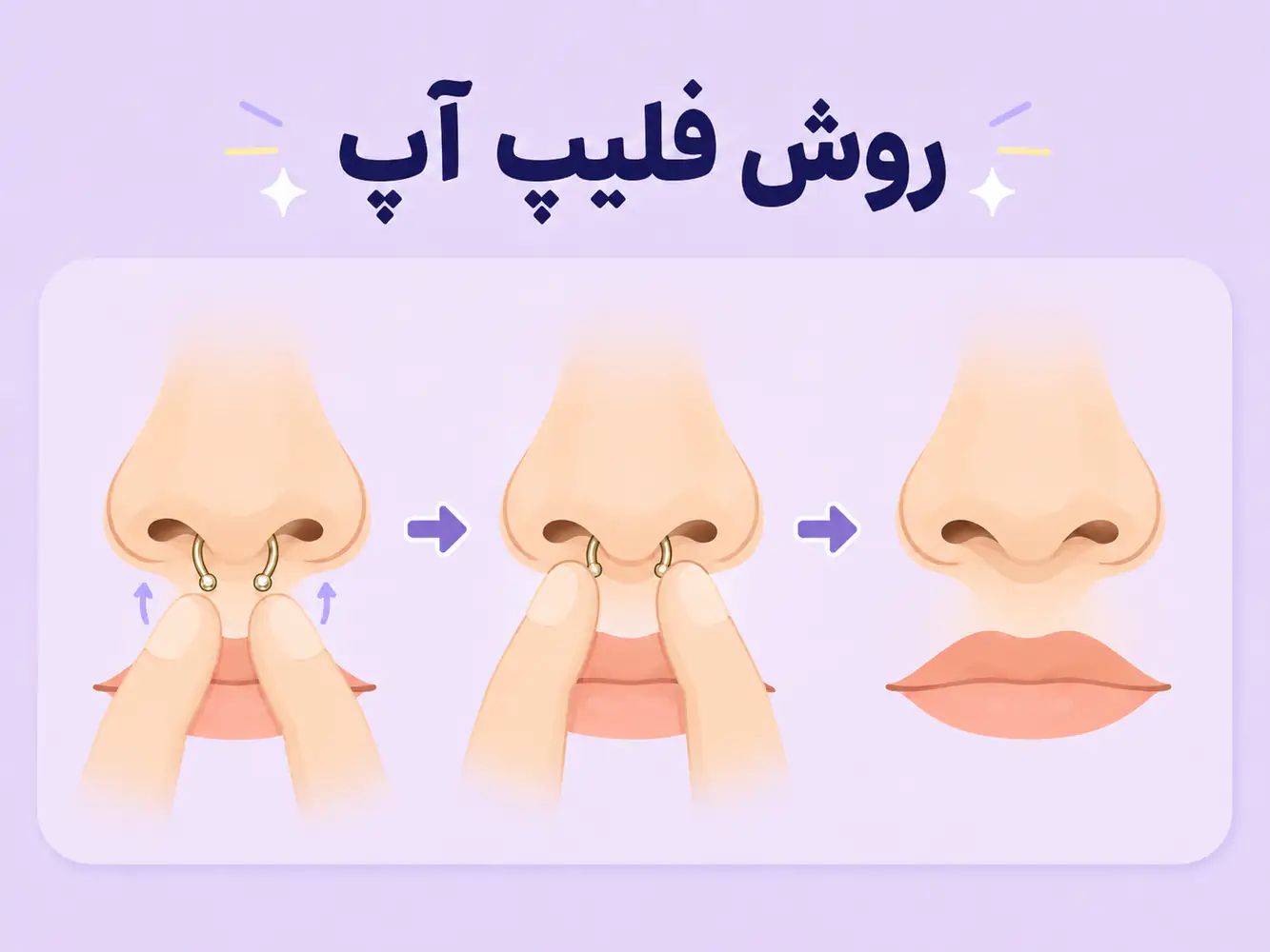 مراحل فلیپ آپ کردن سپتوم