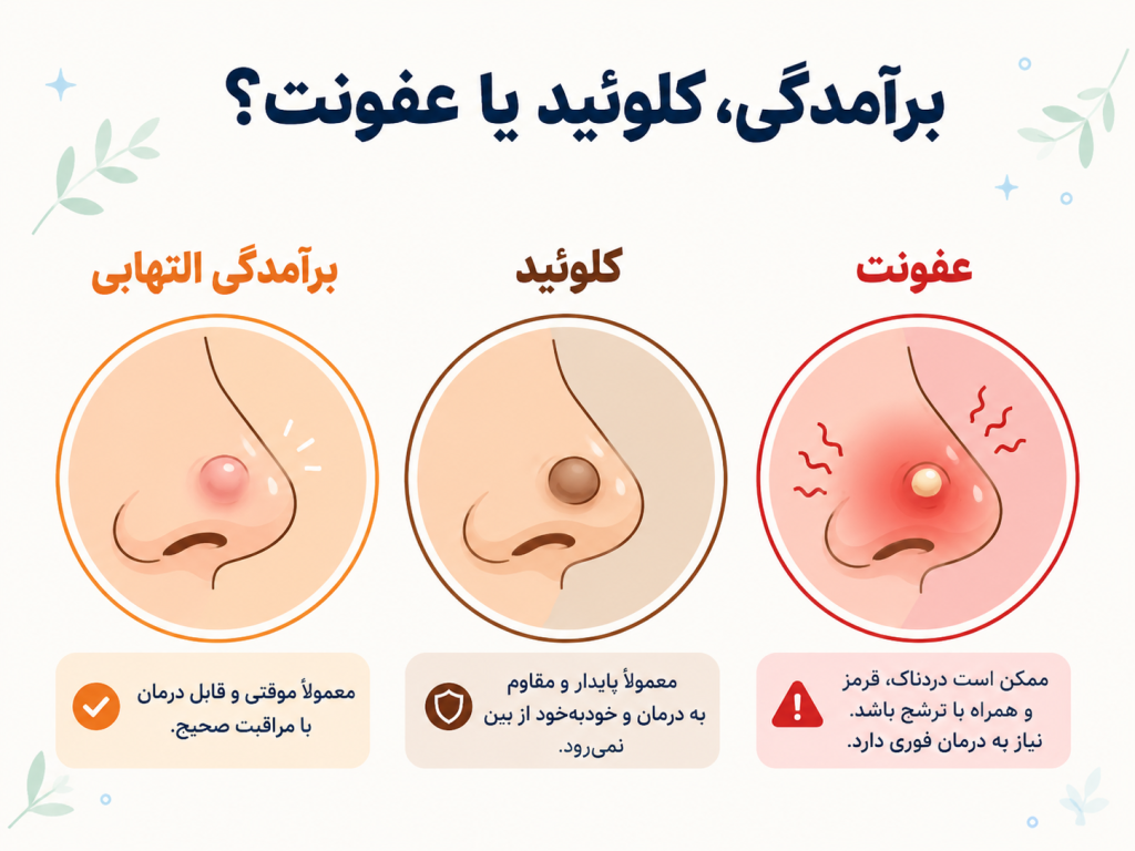 انیمیشن آموزشی تفاوت برآمدگی التهابی، کلوئید و عفونت در پیرسینگ بینی