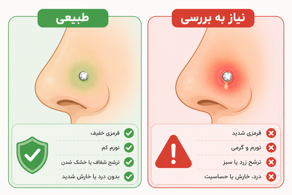 تفاوت علائم طبیعی و عفونت پیرسینگ بینی}