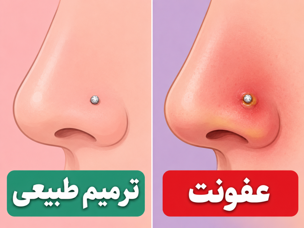 مقایسه پیرسینگ بینی سالم در حال بهبودی با پیرسینگ عفونی