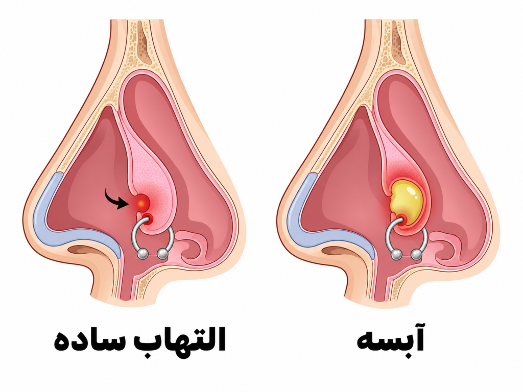 انیمیشن فرق آبسه سپتوم و التهاب ساده پیرسینگ