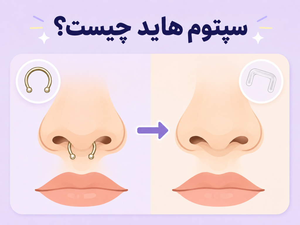 سپتوم هاید چیست