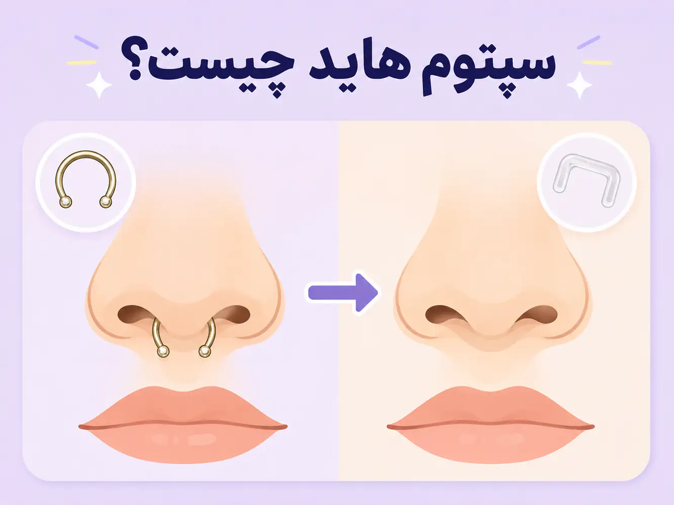 سپتوم هاید چیست