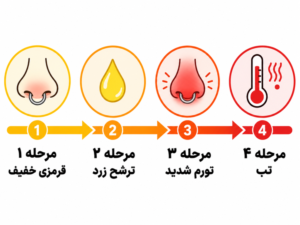 مراحل پیشرفت عفونت پیرسینگ سپتوم از ترشح تا تب