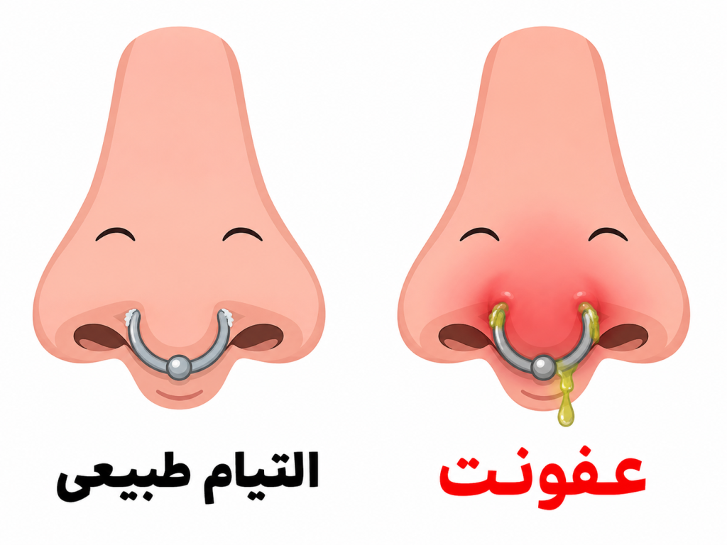 مقایسه سپتوم سالم در حال التیام در برابر سپتوم عفونی