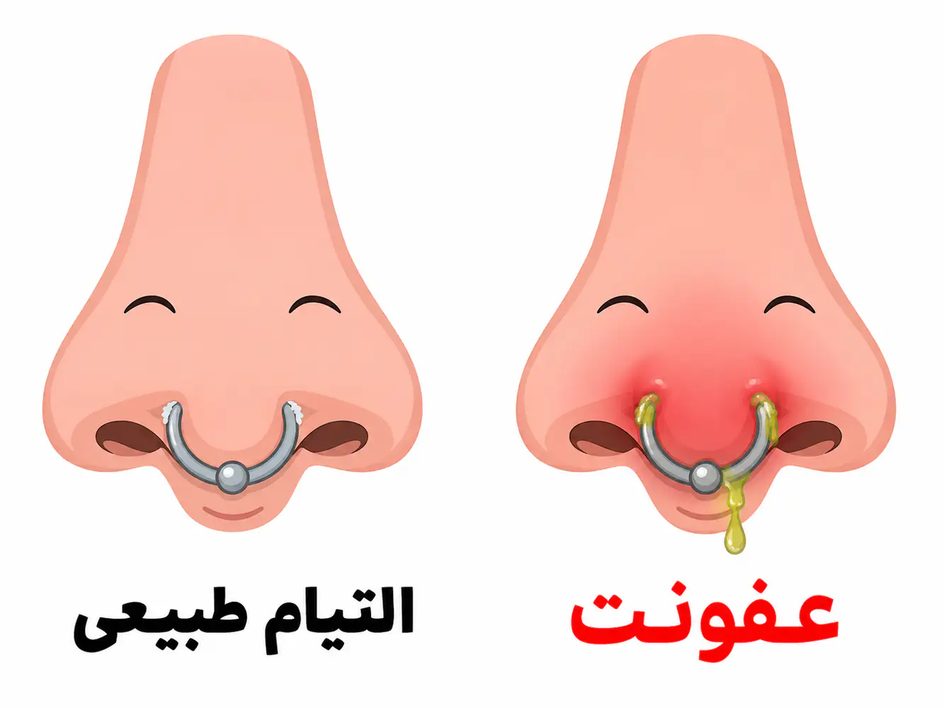 مقایسه سپتوم سالم در حال التیام در برابر سپتوم عفونی