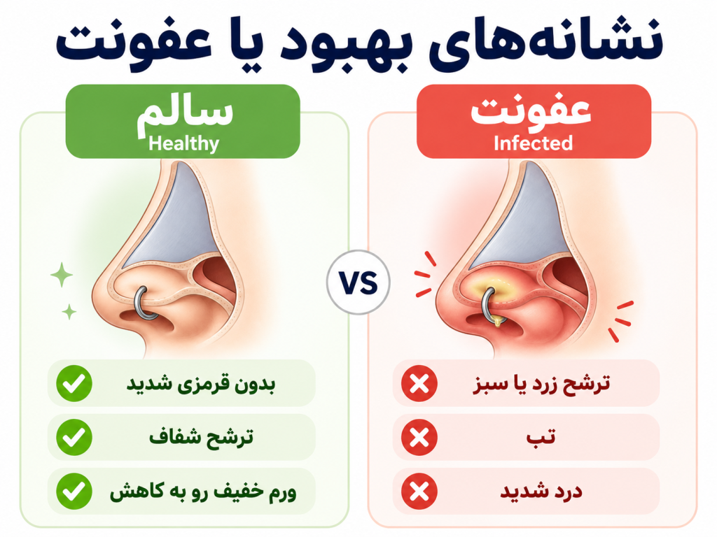 مقیاس درد پیرسینگهای مختلف بینی، سپتوم با سطح درد کم نشان داده شده