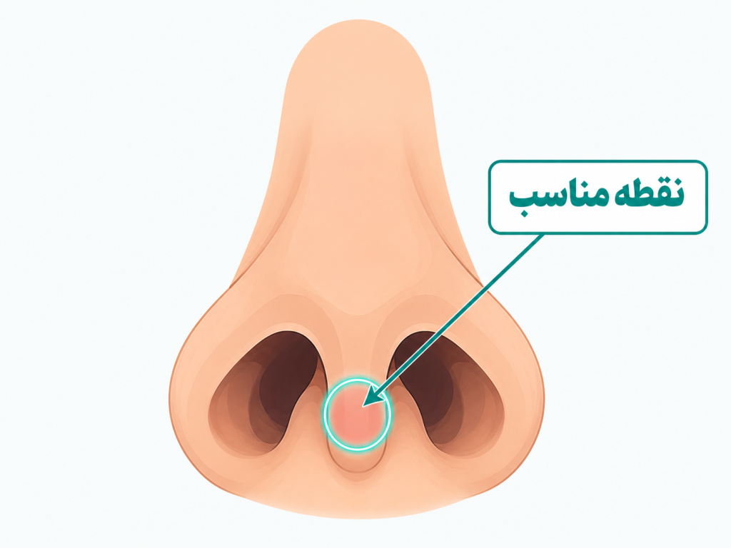 ناحیه سپتوم بینی با نشانه‌گذاری «sweet spot» محل پیرسینگ