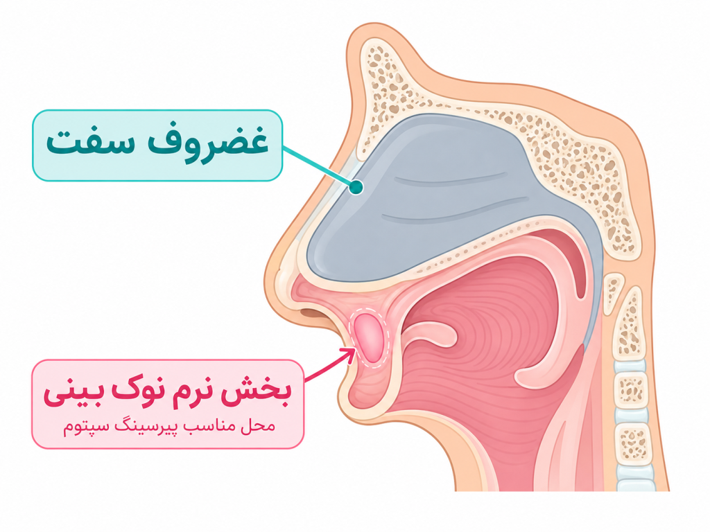 تصویر انیمیشنی از داخل بینی و محل دقیق sweet spot برای پیرسینگ سپتوم