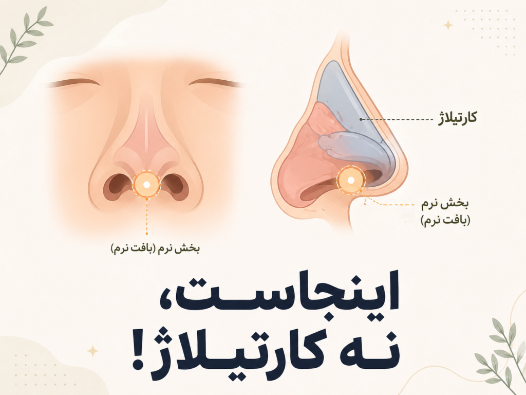 انیمیشن آناتومی بینی با محل دقیق سوییت اسپات سپتوم