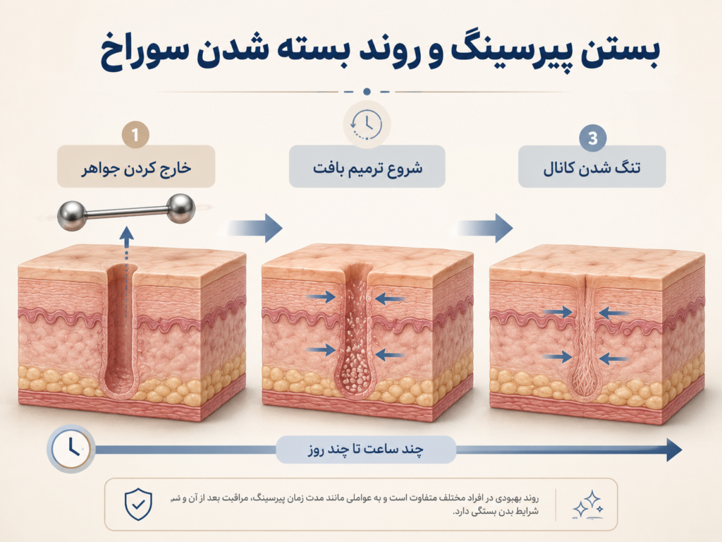 بستن پیرسینگ نوک سینه و روند بسته شدن سوراخ