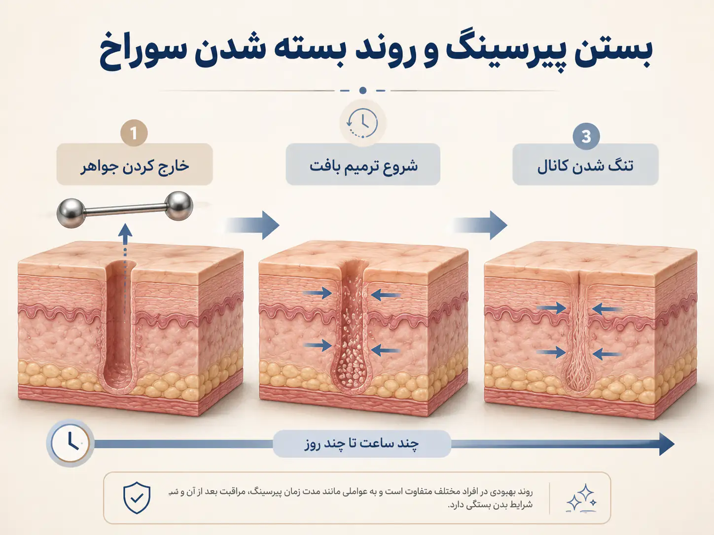 بستن پیرسینگ نوک سینه و روند بسته شدن سوراخ