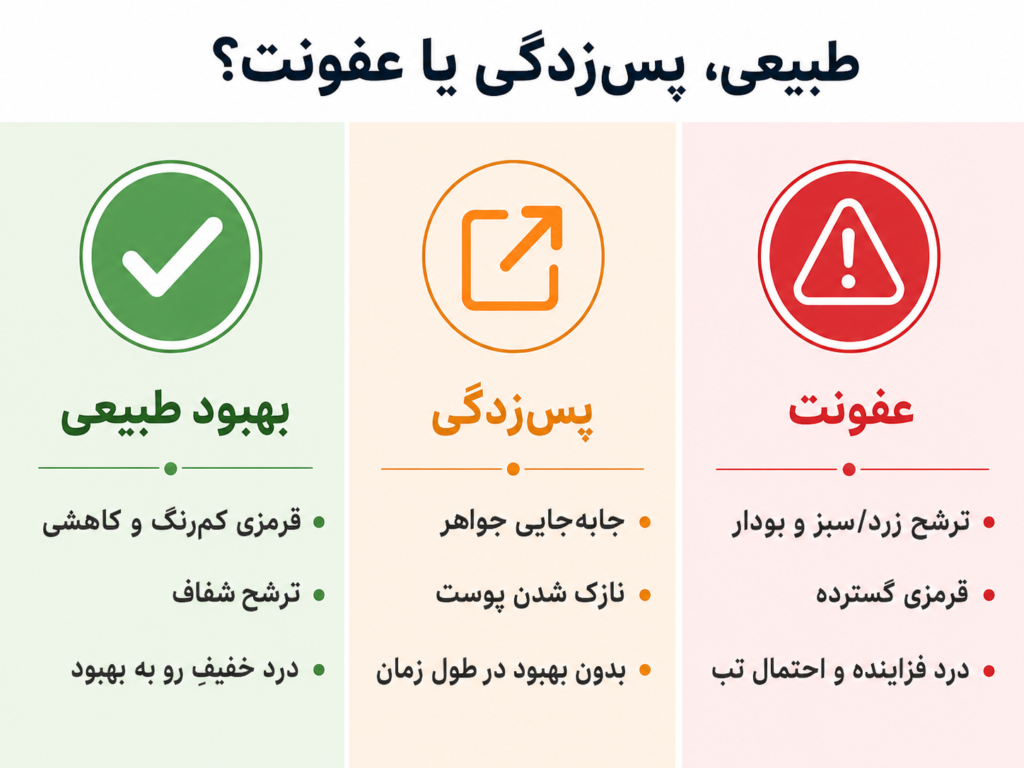 علائم عفونت پیرسینگ ناف شامل قرمزی گسترده و ترشح چرکی