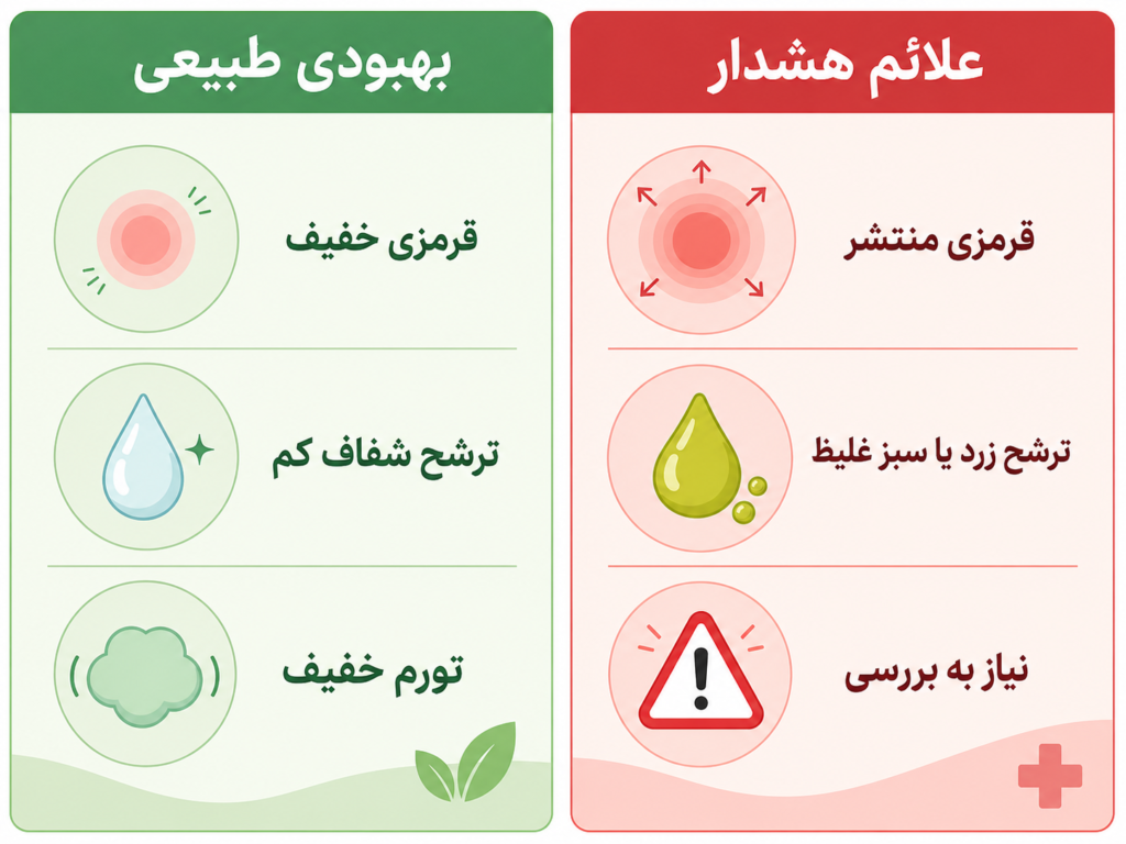 مقایسه تصویری نشانههای طبیعی بهبود پیرسینگ ناف در برابر نشانههای هشداردهنده عفونت
