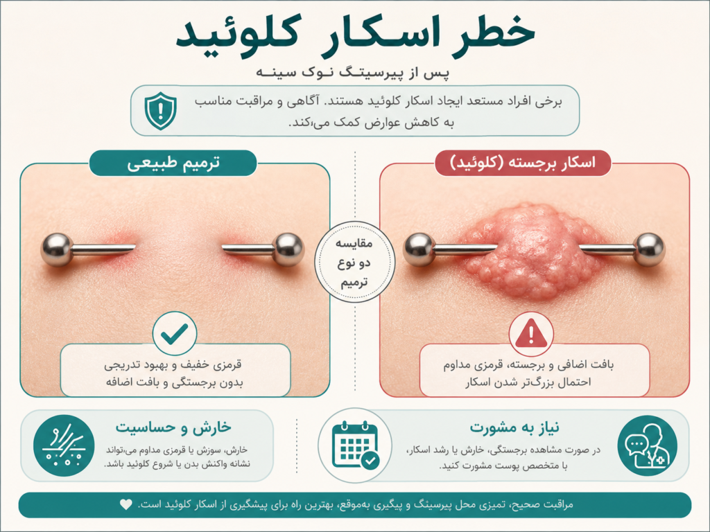 نمونه اسکار کلوئید روی پوست بعد از پیرسینگ
