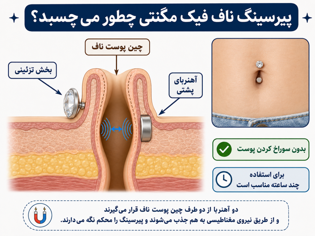 نمای شماتیک مقطعی از نحوه چسبیدن دو تکه پیرسینگ ناف مگنتی از دو طرف چین پوست