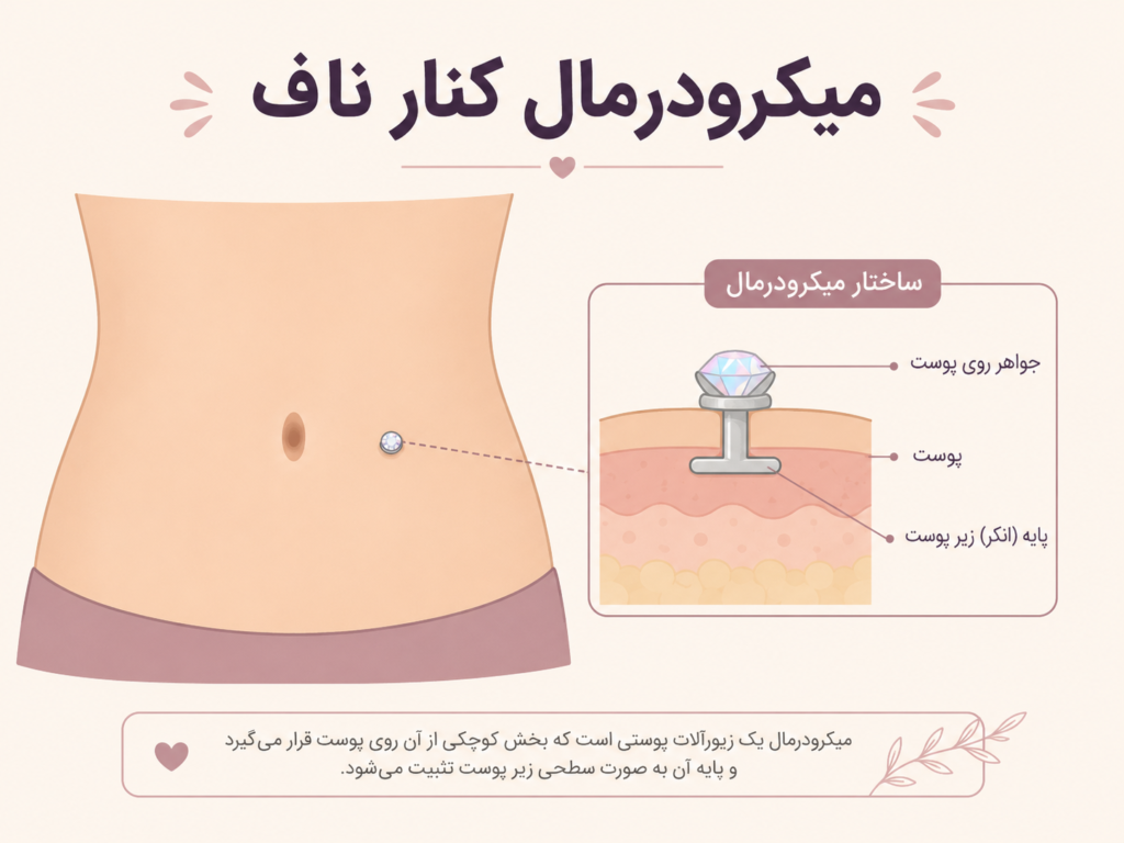 یرسینگ میکرودرمال کنار ناف با نگین کوچک روی پوست