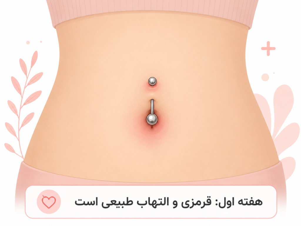 ناف تازه پیرسینگ شده با قرمزی خفیف در روزهای اول التیام