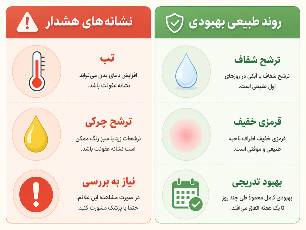 اینفوگرافیک مقایسه علائم طبیعی بهبودی پیرسینگ ناف در برابر نشانه‌های عفونت و رد شدن پیرسینگ