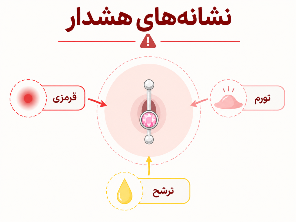 علائم هشدار دهنده عفونت پیرسینگ ناف شامل قرمزی، تورم و ترشح