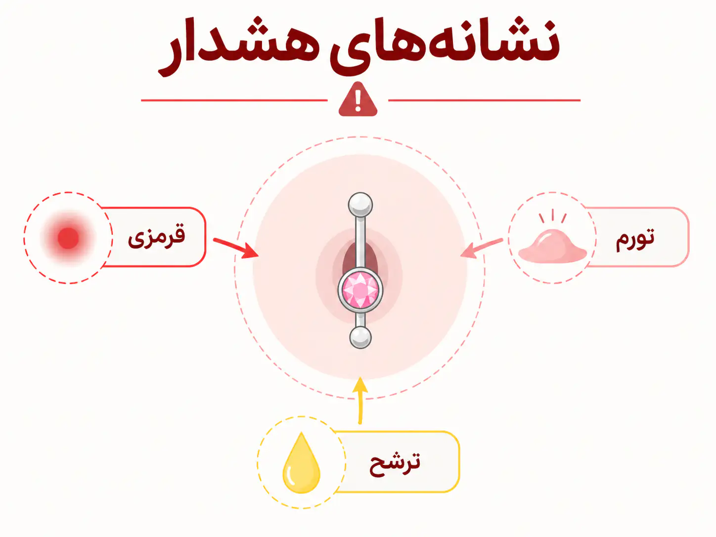 علائم هشدار دهنده عفونت پیرسینگ ناف شامل قرمزی، تورم و ترشح