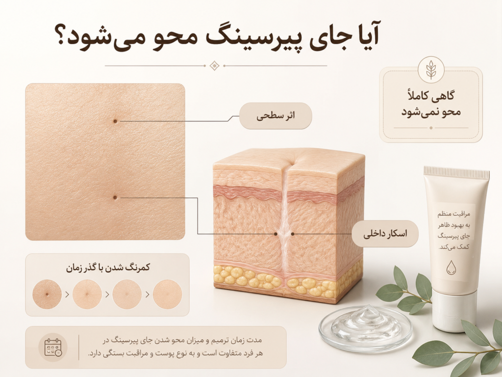 اثر و اسکار باقی‌مانده از پیرسینگ نوک سینه بعد از بسته شدن