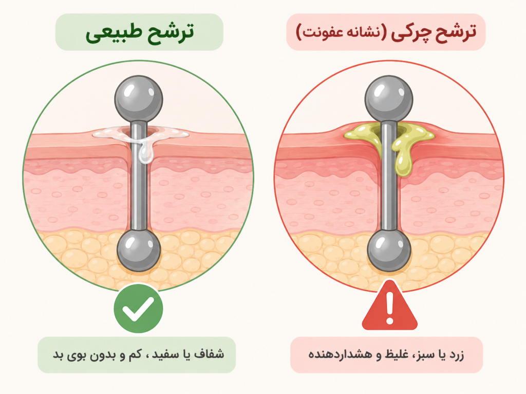 تفاوت ترشح طبیعی لنف با ترشح چرکی در پیرسینگ ناف