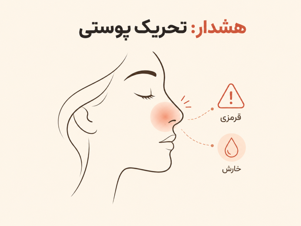علائم حساسیت پوستی روی بینی ناشی از فلز نیکل‌دار