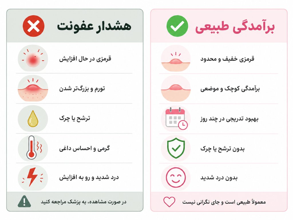 مقایسه بصری پامپ پیرسینگ طبیعی در برابر علائم هشدار عفونت