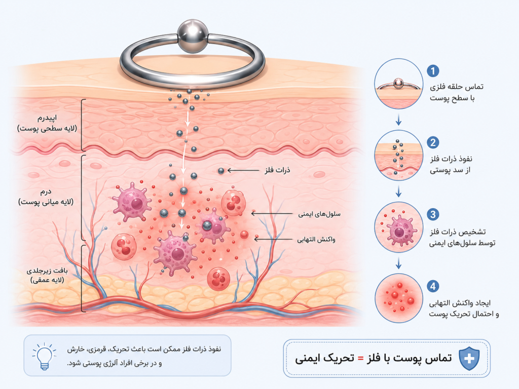 علت حساسیت پوستی به پیرسینگ ناف فیک و تماس فلز با پوست