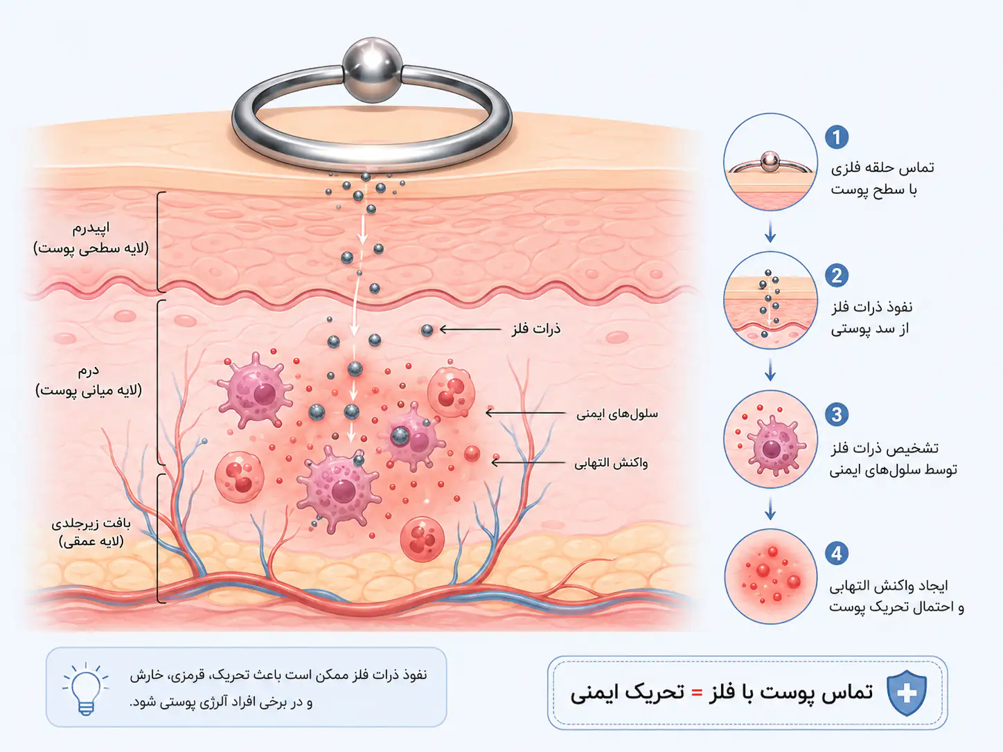 علت حساسیت پوستی به پیرسینگ ناف فیک و تماس فلز با پوست