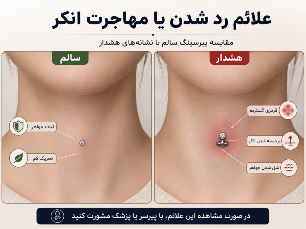نمایش مقایسه‌ای پیرسینگ گلو سالم در برابر علائم اولیه مهاجرت یا رد شدن