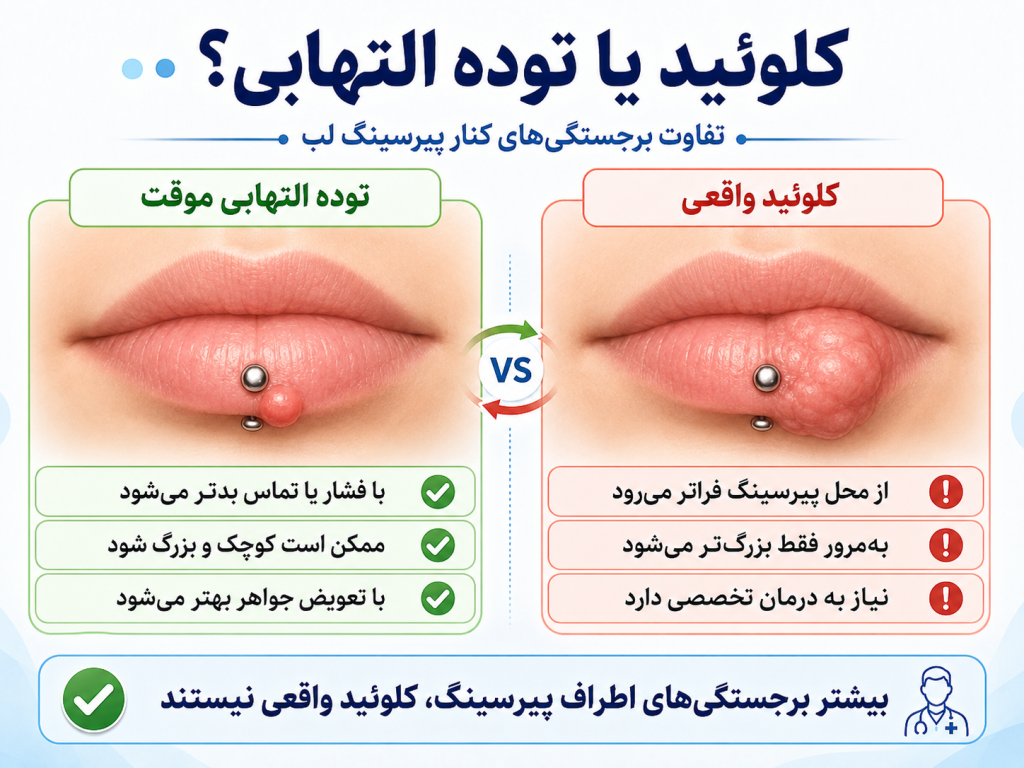 تفاوت کلوئید و توده التهابی موقت در پیرسینگ لب