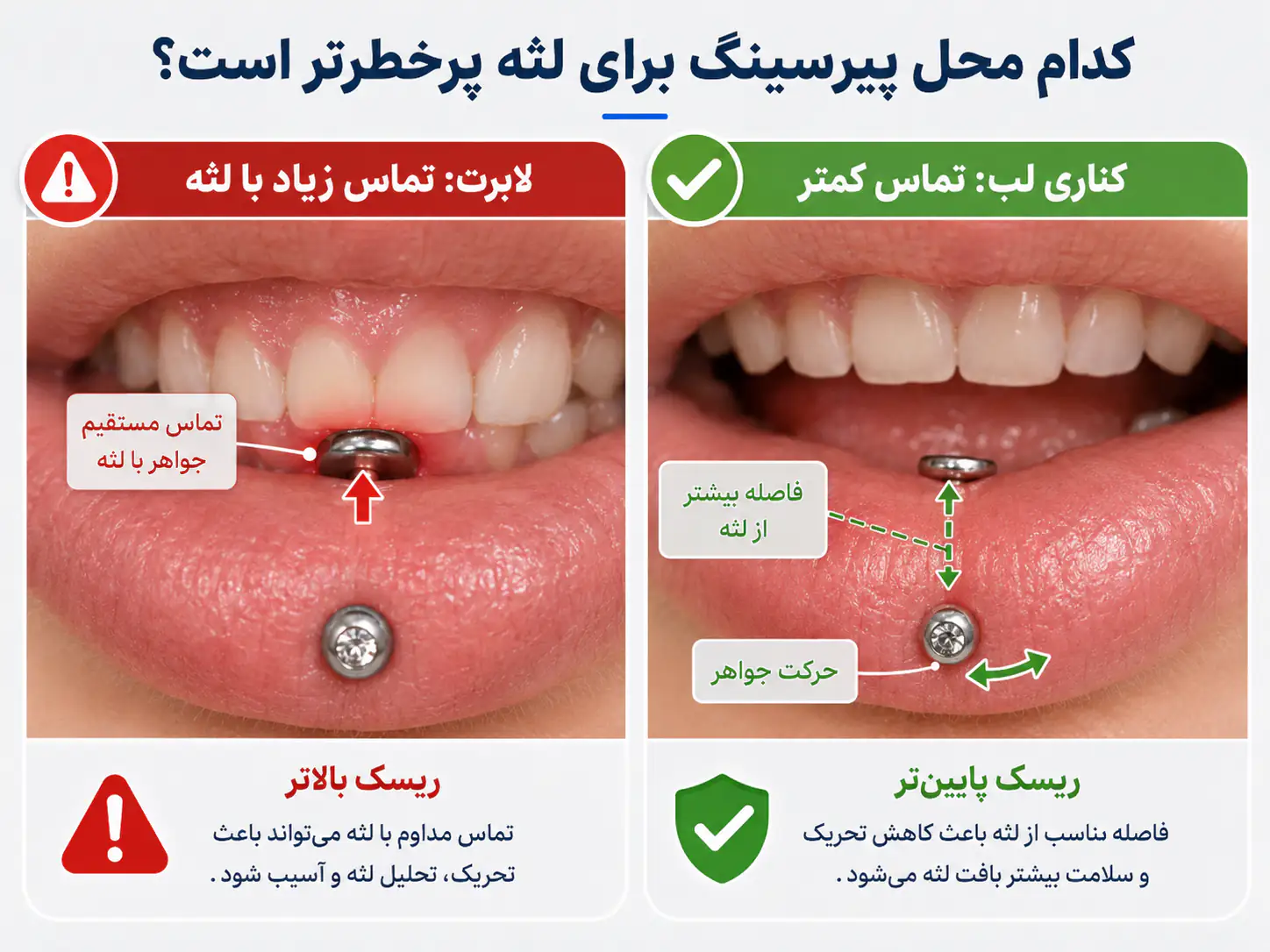 مقایسه پیرسینگ لابرت و پیرسینگ کناری لب از نظر تماس با لثه