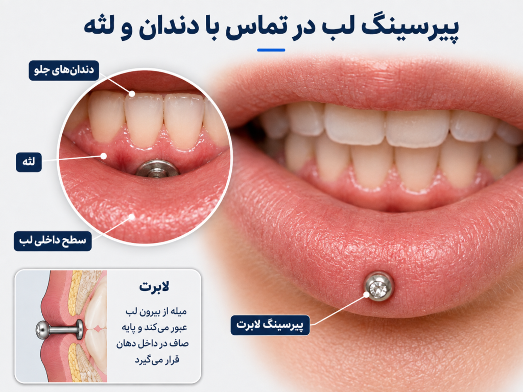 عکس نزدیک از پیرسینگ لب کنار دندان و لثه ا