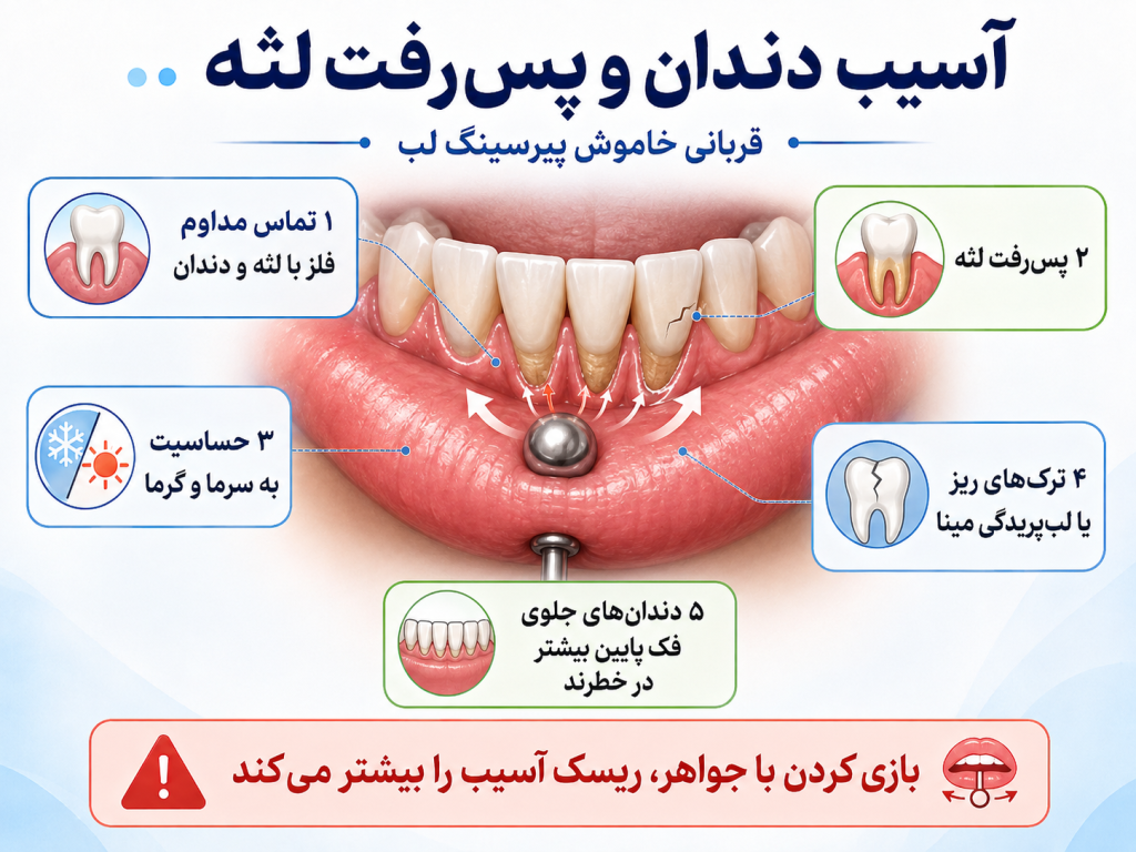 آسیب دندان و پس‌رفت لثه در اثر پیرسینگ لب