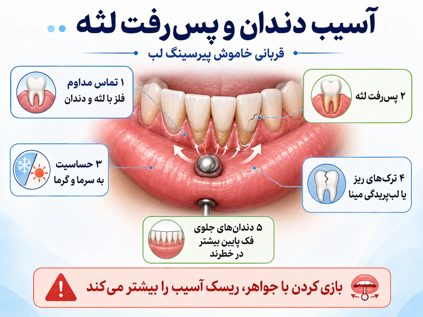 آسیب دندان و پس‌رفت لثه در اثر پیرسینگ لب