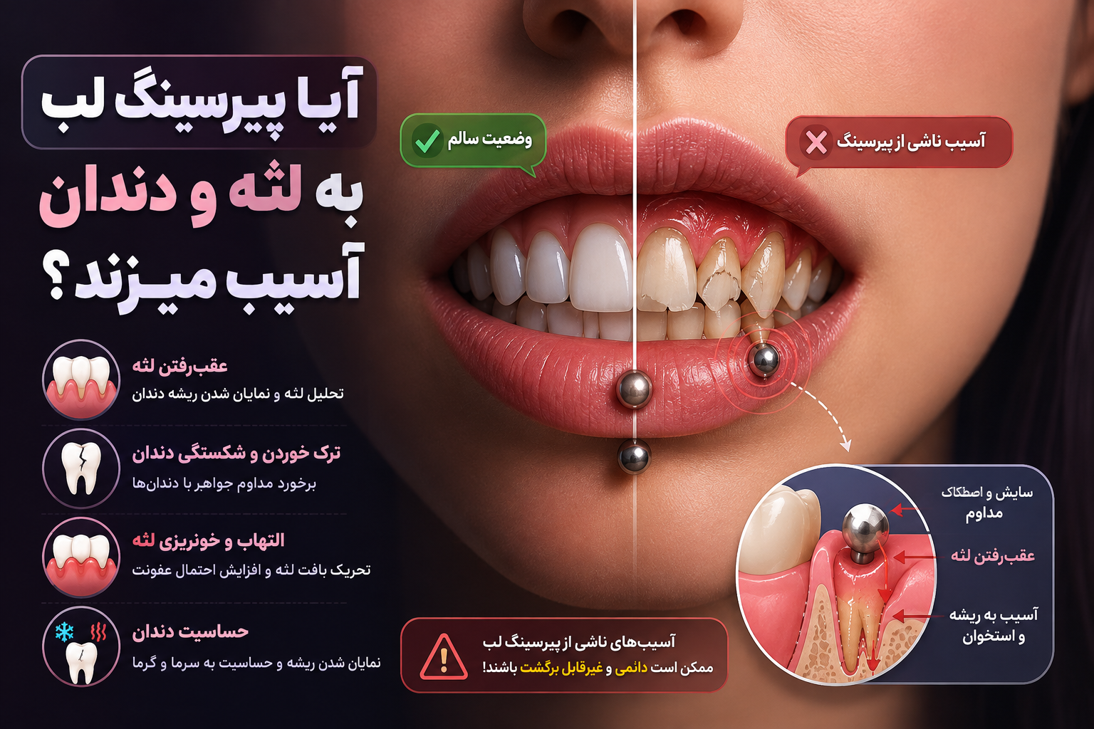 آیا پیرسینگ لب به دندان و لثه آسیب می‌زند؟ عوارض و راه‌های پیشگیری
