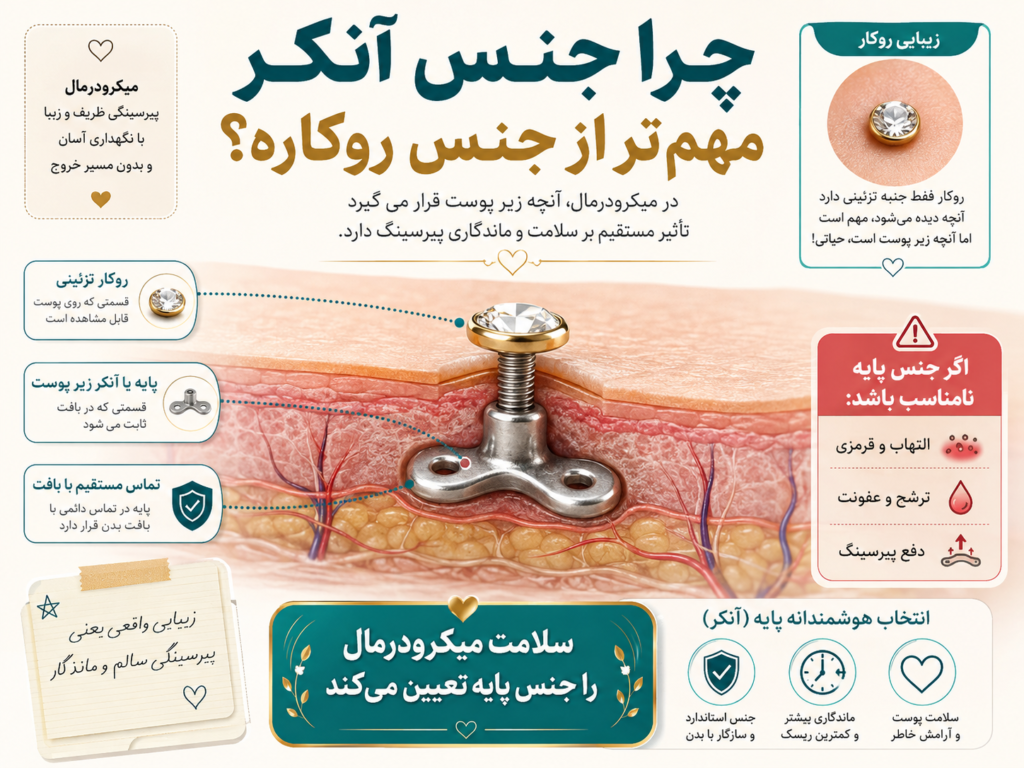 مقایسه ساختار آنکر میکرودرمال زیر پوست با پایه فلزی و روکار تزئینی
