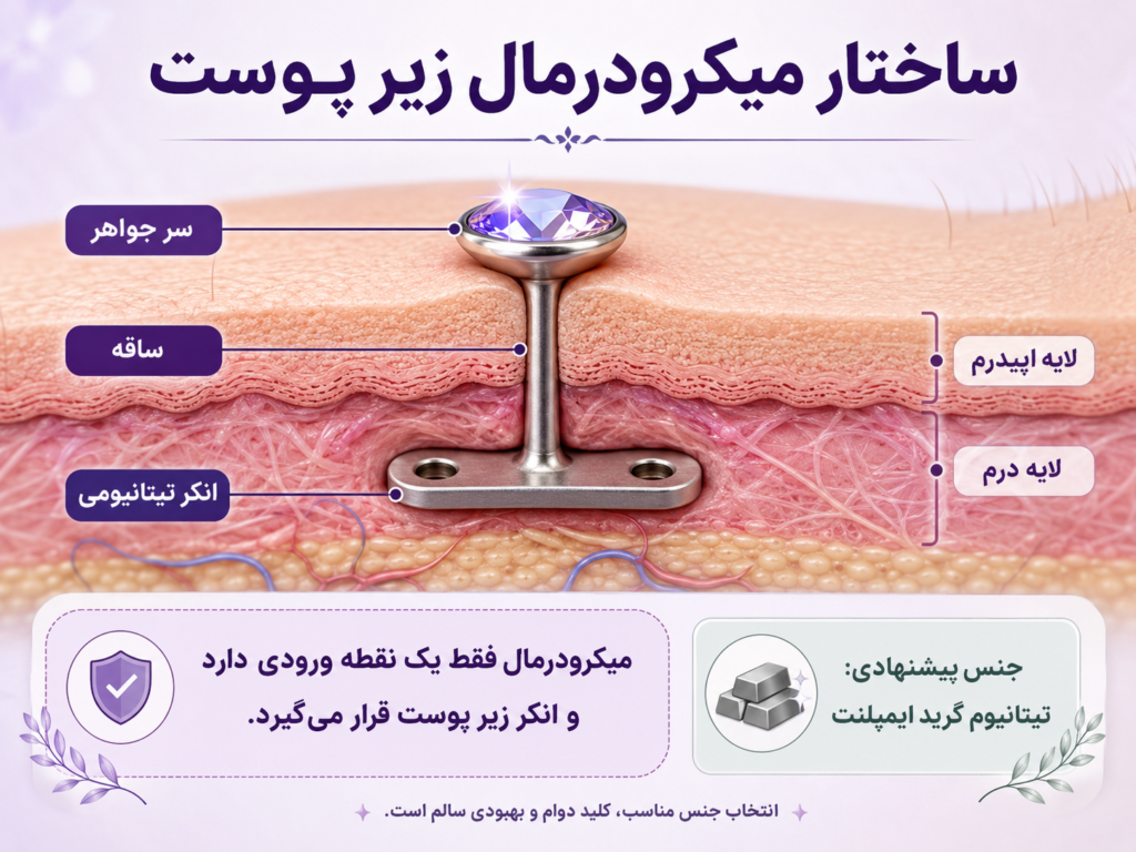 ساختار زیر پوستی میکرودرمال و نحوه قرارگیری انکر تیتانیومی زیر لایه درم