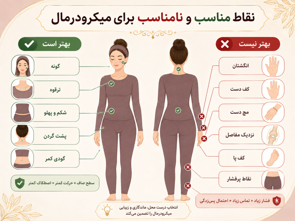 مقایسه نقاط مناسب و نامناسب برای پیرسینگ میکرودرمال روی بدن