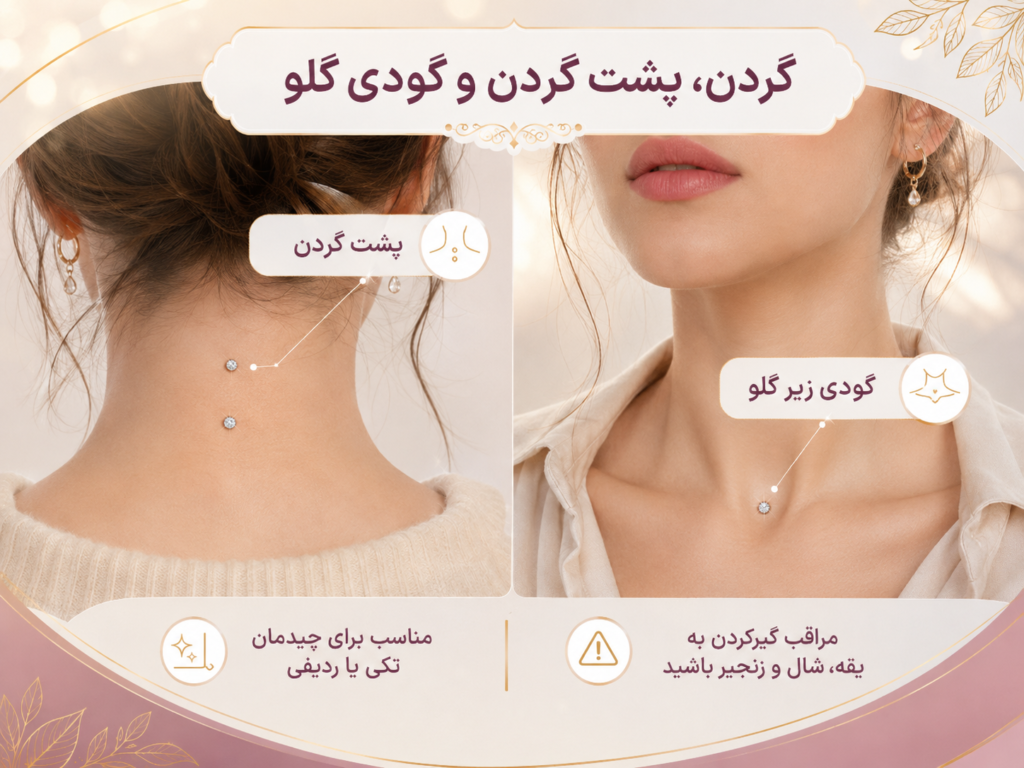 میکرودرمال روی پشت گردن به شکل ردیفی