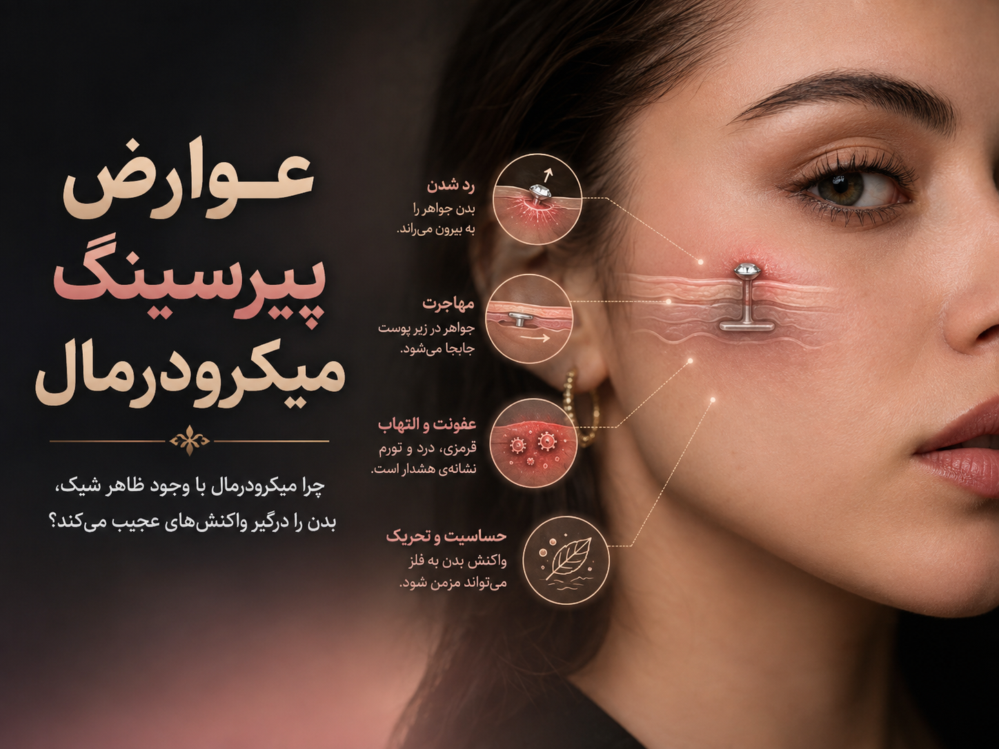 عوارض پیرسینگ میکرودرمال – چرا میکرودرمال با وجود ظاهر شیک، بدن رو درگیر یه سری واکنش‌های عجیب می‌کنه؟