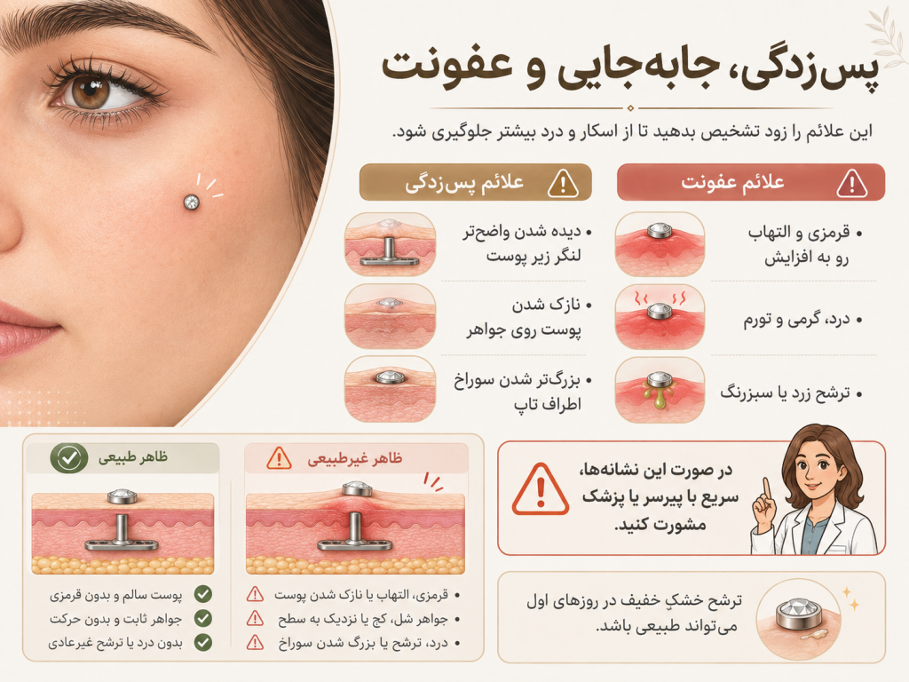 نشانه‌های پس‌زدگی و عفونت در پیرسینگ میکرودرمال روی پوست