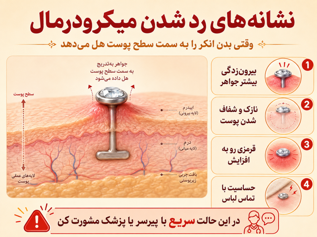 نشانه‌های رد شدن میکرودرمال شامل بیرون زدگی جواهر و نازک شدن پوست اطراف