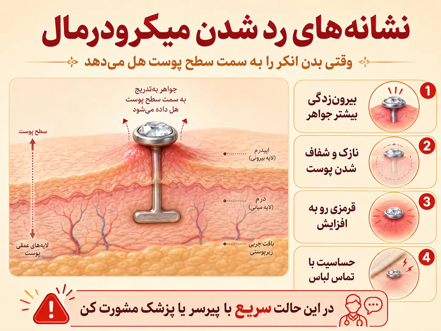نشانههای رد شدن میکرودرمال شامل بیرون زدگی جواهر و نازک شدن پوست اطراف