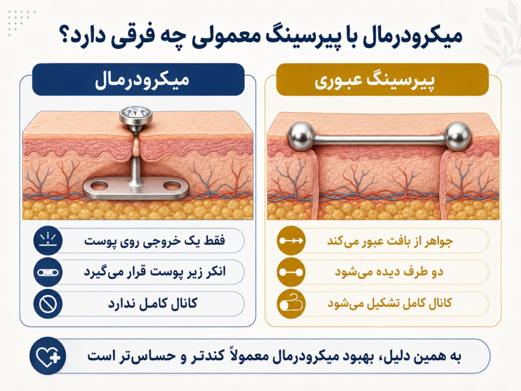 مقایسه بصری ساختار میکرودرمال زیر پوست با پیرسینگ معمولی عبوری